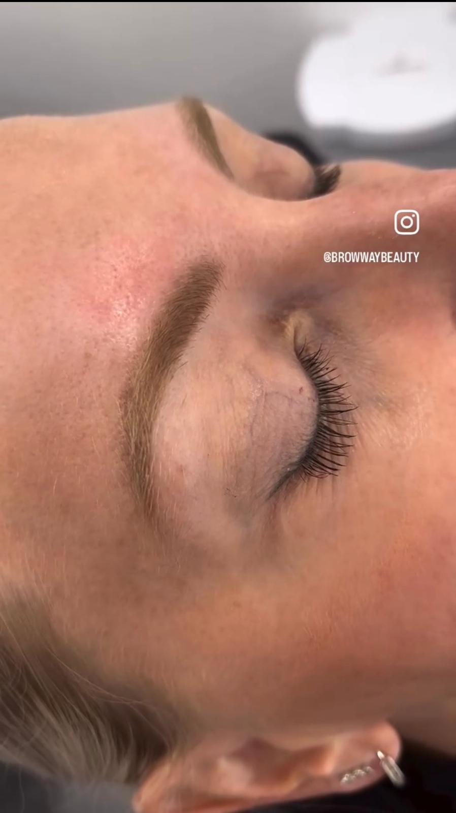 Fluffy, Lifted Brows - Before