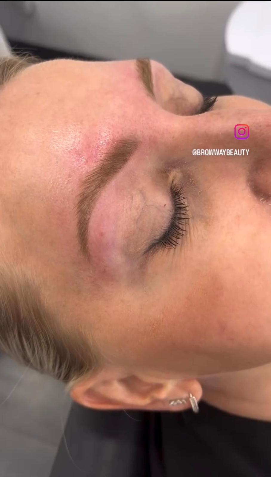 Fluffy, Lifted Brows - After